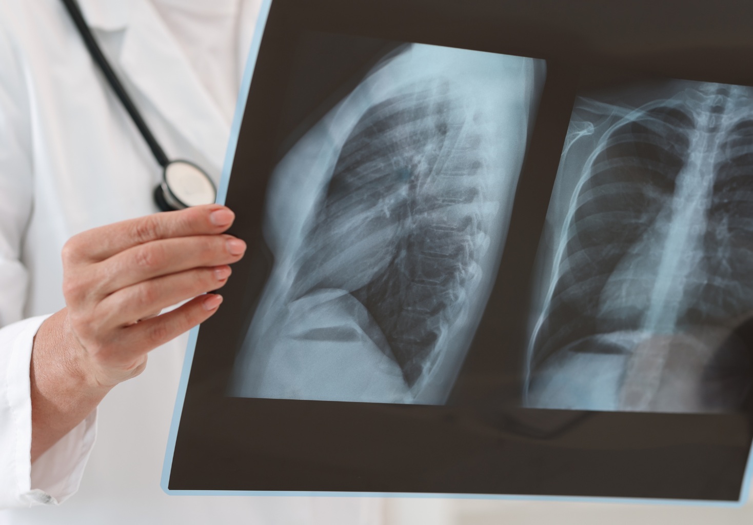 Poradnia Chorób Płuc dla Dzieci