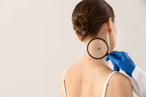 Poradnia Dermatologiczna dla Dzieci i Dorosłych