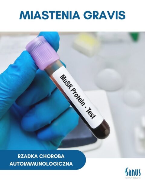 Miastenia Gravis