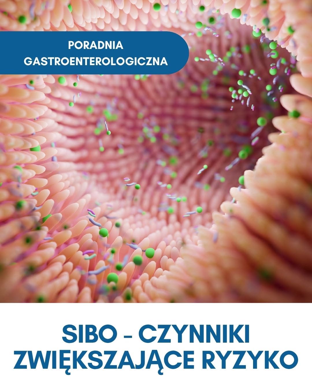SIBO – czynniki zwiększające ryzyko